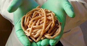 Parasitos extraídos do corpo humano