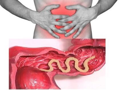 Os signos de helmintiase crónica son enfermidades dispépticas do intestino