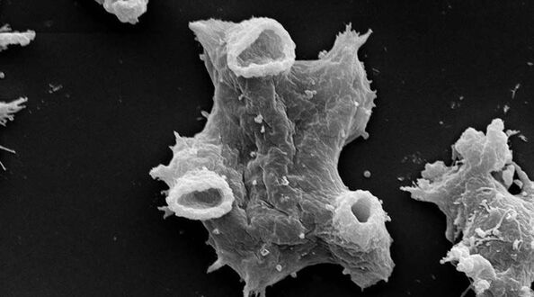 Negleria fowlera é un parasito unicelular perigoso para a vida humana. 