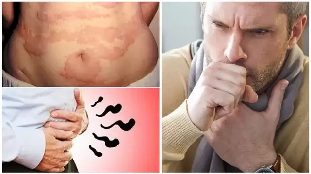 As alerxias, a tose e os gases son signos de dano ao corpo por vermes