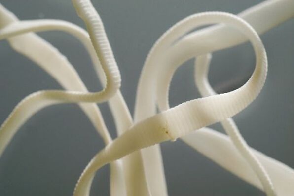 Ascaris é un nematodo e pertence á orde dos vermes redondos